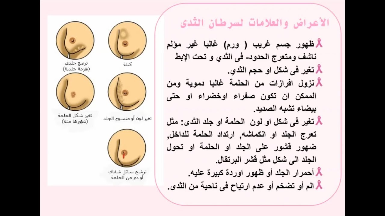 علامات سرطان الثدي
